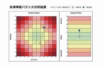 エナジーテラピーとは La Santeのエナジーテラピーの6つの特徴と生体電流についてのご紹介